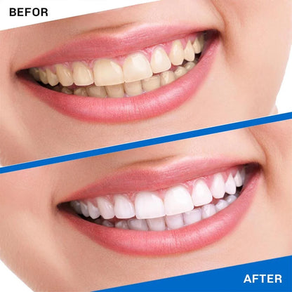 5D White Teeth Whitener, 28 Non-Sensitive Snow Teeth Whitening Strips for Teeth, Gentle and No Sour Teeth, Helps to Remove Smoking Coffee Wine Stain